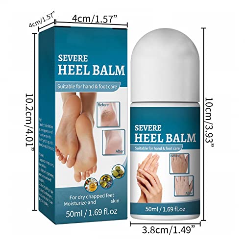 peta lopta omekšavanje duboko hidratantna pogodna za suhu kožu stopala ruku peta noktiju lakata uklanjanje kože sa stopala